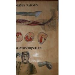 Medisch Nervus Radialis Handbeschilderd Linnen 150 x 109!!!