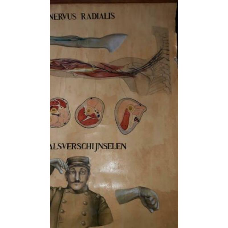 Medisch Nervus Radialis Handbeschilderd Linnen 150 x 109!!!